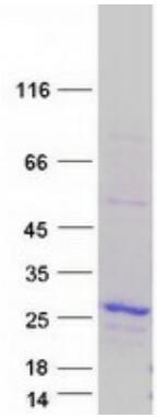 Coomassie blue staining of purified BAX protein.